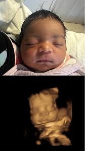 3D 4D Ultrasound Studio LLC