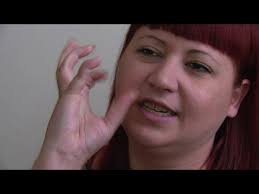 TRIGEMINAL NEURALGIA