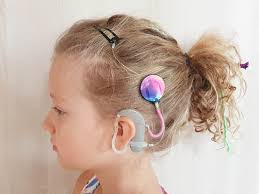 Mini size invisible hearing aid 3. Single Invisible Hair Clip Hook For One Processor Hearing Aid Black Holder With Hairpin Black Protectors Holders Single