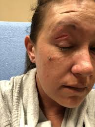 Accident Prone Boxer Dogs and Their High Energy Levels