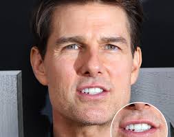 Tom Cruise Teeth 's Middle Tooth The Story Behind His Smile