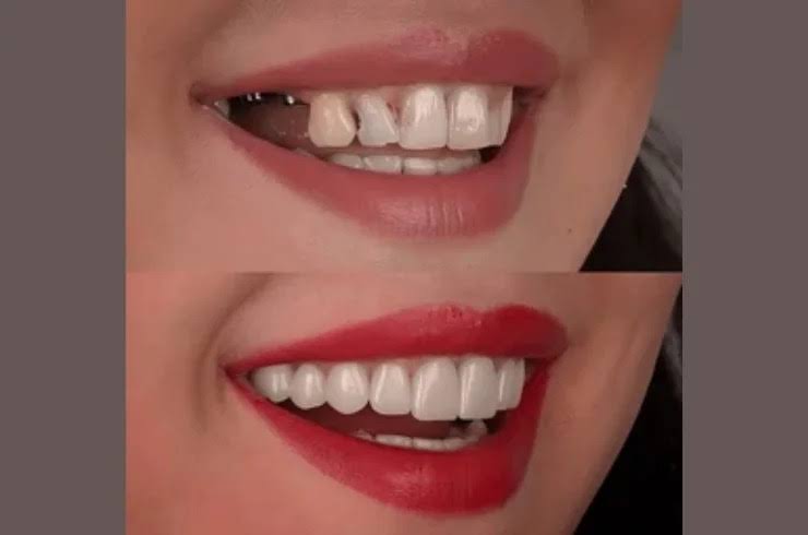 Smile Makeover product image