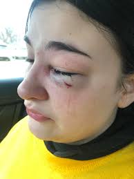 Texas Teacher Injured by Student, Calls for Classroom Safety and Education  Reform