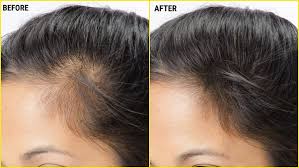 Naturally, the gland on scalp manufactures the oil which gives protection to each hair strand. What Are The Benefits Of Bajaj Almond Oil On Hair Quora