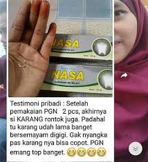 5 Manfaat Pasta Gigi Nasa Untuk Karang Gigi Review Harga Cara Pakai Perbedaan Asli Dan Palsu