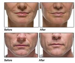 Dr. Melda Isaac, Board-Certified Dermatologist in Washington, DC