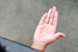 Penyebab jari tangan kebas lainnya menurut dr. Pengambilan Lengan Atau Kaki