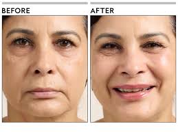 The 9 Best Lip Plumpers, Tested and Reviewed