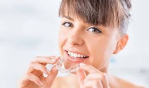Invisalign Attachments: A Closer Look at Their Role in Transforming Smiles