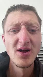 Daniel Corson Empuja A Su Esposa