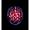 Emergency nursing ceu courses emergency nursing continuing education courses focus on best practices for emergency nurses. Stroke Continuing Education Courses For Nurses Nurse Com