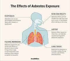 Here we look at some of the key symptoms of this disease to watch out for. What S The Link Between Asbestos And Lung Cancer