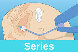 Urinary Catheters 2 Inserting A Catheter Into A Female Patient Nursing Times