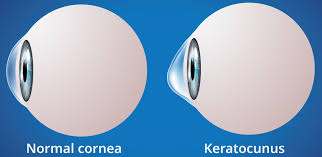 Image result for Sclera