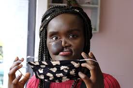 BBC monologue explores life with a visible difference