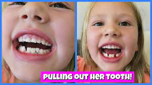 Help prevent tooth decay and future dental work. Pulling Out Her Loose Tooth Youtube