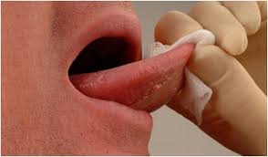 Image result for cancer tongue symptoms)