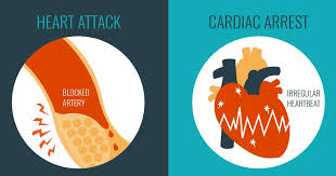 Cardiac arrest is usually caused by electrical disturbances in the heart. Heart Attack Vs Cardiac Arrest What S The Difference