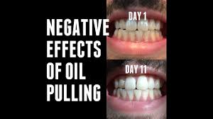 Oil Pulling Experiments Negative Side Effects Day 11 Coconut Oil For Teeth Coconut Oil Pulling Benefits Coconut Oil Pulling Teeth