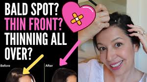 So mainly here we need to reduce the hormone effect. Hiding Thinning Hair On Top For Females Hairstyle Tips For Bald Spots Thin Fronts And Parts Youtube