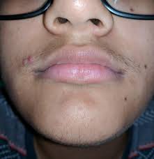 The dye is specifically designed for the male beard. Will Beard Dye Help My Facial Hair Stand Out More Ftm