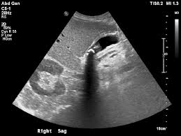 Maybe you would like to learn more about one of these? Gallbladder Case 2 Emottawa Blog