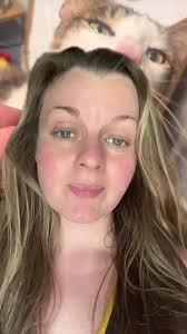 Milo and Shaelynn Update: Resilient Cat Rescue Efforts