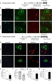 30 minutes with … each week, we spend half an hour (or thereabouts) with a musician or film. Mechanical Stretch Of High Magnitude Provokes Axonal Injury Elongation Of Paranodal Junctions And Signaling Alterations In Oligodendrocytes Springerlink