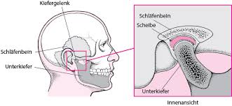 Kiefergelenkerkrankungen Mund Und Zahnerkrankungen Msd Manual Ausgabe Fur Patienten