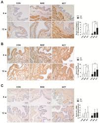 Image result for Methoxetamine