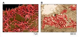 Marburg virus, a cousin of ebola virus, causes severe hemorrhagic fever, with up to 90% lethality seen in recent outbreaks. Filoviridae A Scanning Electron Micrograph Of Marburg Virus Particles Download Scientific Diagram