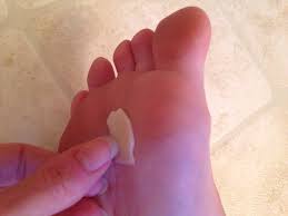 Make a paste with baking soda and water and apply to the splinter area. How To Remove A Splinter With A Potato Slice B C Guides