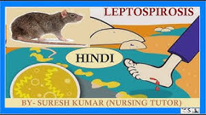 Kencing tikus dalam istilah perubatan dipanggil sebagai penyakit leptospirosis. Leptospirosis Youtube
