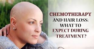 In the majority of people, chemotherapy results in almost complete hair loss within the first four to eight weeks of treatment, says lacouture. Regrow Hair After Chemotherapy Hair Restoration Clinic Lahore Pakistan