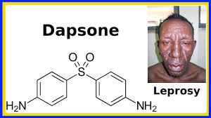 Image result for Dapsone