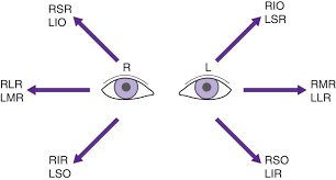 Image result for Eye Deviation