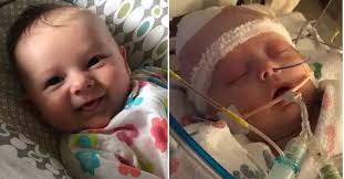 Baby Gets Hit in the Head With a Softball