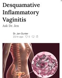 Image result for Vaginitis