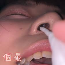 個人撮影】ハスキーボイスな女の子の鼻の穴 はるみ【Y-180】 | アダルト動画・画像のコンテンツマーケット Pcolle