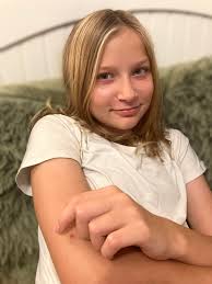 A one-of-a-kind hospital gown was finished this evening by my sister  Desiree Audrina Marshall and myself, for a tiny but mighty girl who reminds  us all that sometimes life gives you Lemons...and