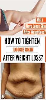 How To Tighten Loose Skin And Sagging Skin In 2020 Tighten Stomach Tighten Loose Skin Loose Skin