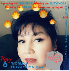 MoyaMoya-The Disease I Own