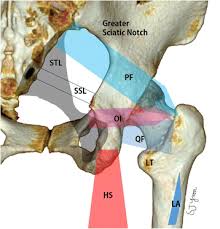 Clinical Results Of Endoscopic Sciatic Nerve Decompression For Deep Gluteal Syndrome Mean 2 Year Follow Up Bmc Musculoskeletal Disorders Full Text