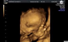 3d 4d Ultraschall Babyviewing Tv Home Facebook