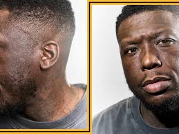 Nate Robinson Talks Dialysis, Kidney Failure, & Search for Kidney