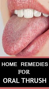 Home Remedies For Oral Thrush Lifestyle 365 Oral Thrush Remedies Home Remedies For Thrush Yeast Infection Symptoms