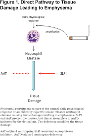 This may result in shortness of breath, wheezing, or an increased risk of lung infections. The Pathophysiology Of Antitrypsin Deficiency Journal Of The Copd Foundation