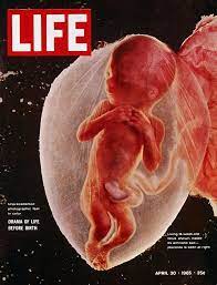 Toute femme qui ne souhaite pas poursuivre sa grossesse jusqu'à son terme a la possibilité d'y recourir et elle est la seule à pouvoir prendre cette décision. Foetus De 4 Mois Photo Une Majorite Politique S Apprete A En Autoriser L Avortement Institut Europeen De Bioethique