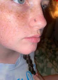 So i got this pierced a couple weeks ago and i clean it every day with  saline solution but i have this bump