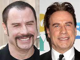 12 Male Celebs With Toupee Hair System